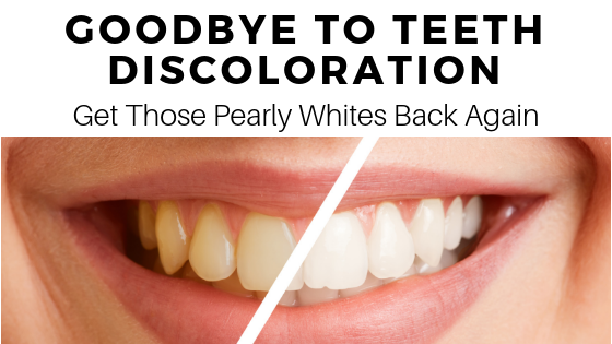 Goodbye to Teeth Discoloration